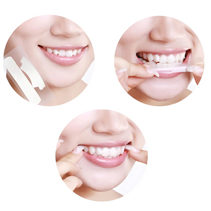 Smilumin – Zobu kopšanas komplekts ar LED gaismu un balinošām sloksnēm